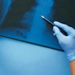 Pain and Suffering Damages in Injury Claims