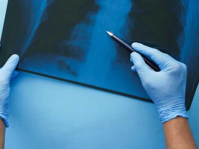 Pain and Suffering Damages in Injury Claims