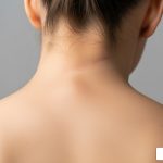 whiplash neck injury - what is whiplash